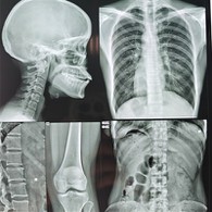 X-ray Printer Hospital Film